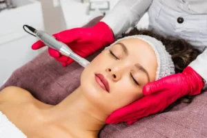 RF Microneedling by NUYU Med Spa in Albuquerque, NM