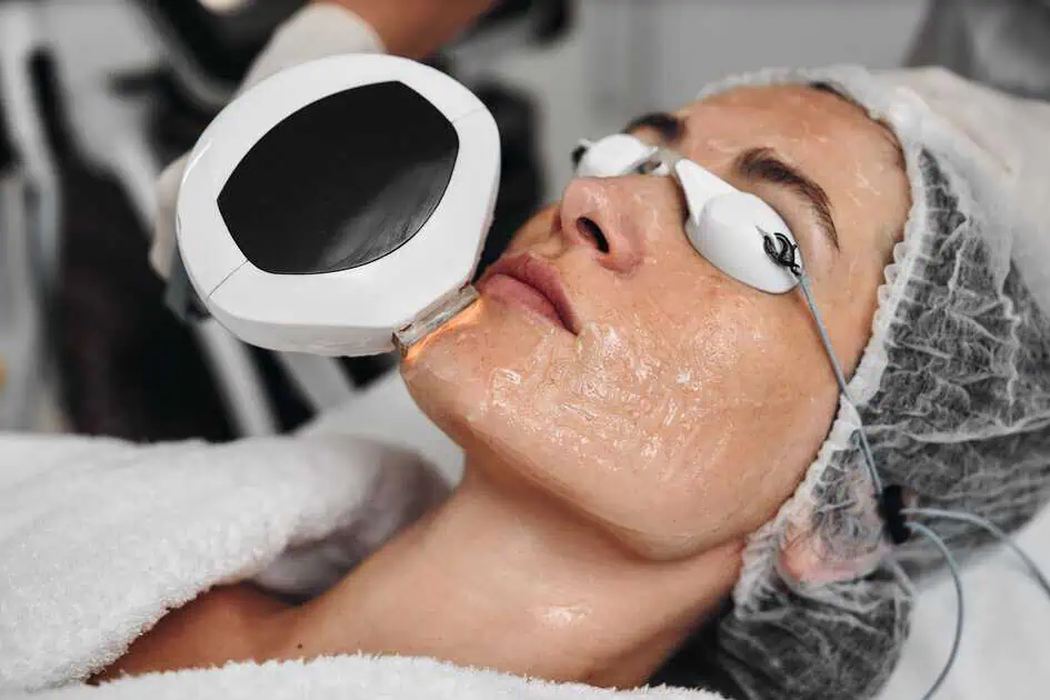 IPL Photofacial Treatment by Nuyu Med Spa in Albuquerque, New Mexico