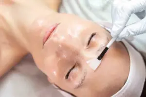 Medical-Grade Chemical Peel treatment being performed at NUYU Med Spa