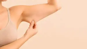 PDO thread lift for arms to improve loose upper-arm skin in Albuquerque, NM